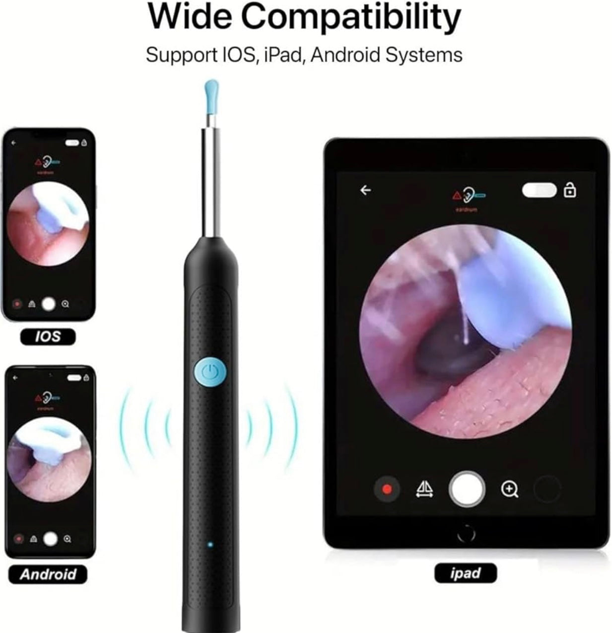 Smart Visual Earwax Cleaner with 1080P WiFi Camera & LED Light – Rechargeable Ear Cleaning Tool