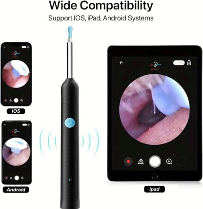 Smart Visual Earwax Cleaner with 1080P WiFi Camera & LED Light – Rechargeable Ear Cleaning Tool